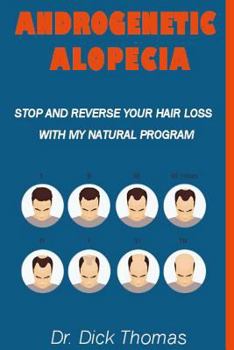 Paperback ANDROGENETIC ALOPECIA (Stop and Reverse your Hair Loss with my Natural Program): The End of Hair Loss and Balding, Hair Loss Prevention and Fast Regro Book