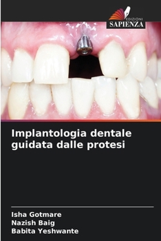 Paperback Implantologia dentale guidata dalle protesi [Italian] Book