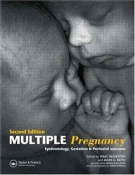 Hardcover Multiple Pregnancy: Epidemiology, Gestation, and Perinatal Outcome Book