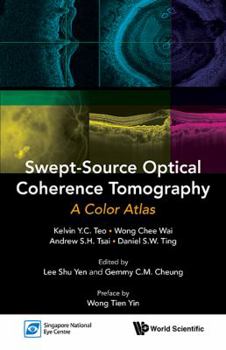 Paperback Swept-Source Optical Coherence Tomography: A Color Atlas Book