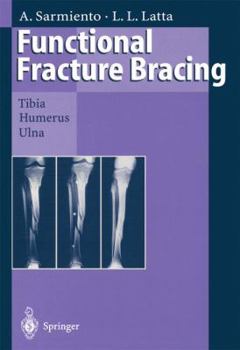 Paperback Functional Fracture Bracing: Tibia, Humerus, and Ulna Book