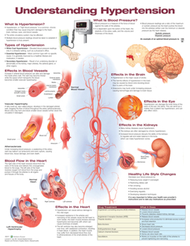 Wall Chart Understanding Hypertension Anatomical Chart Book