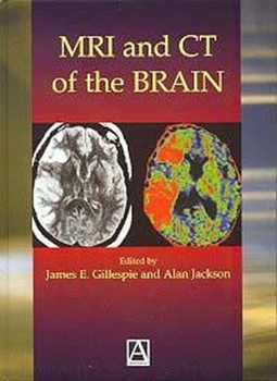 Hardcover MRI and CT of the Brain Book