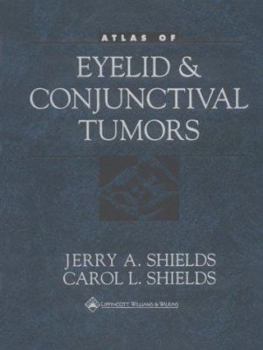 Hardcover Atlas of Eyelid and Conjunctival Book