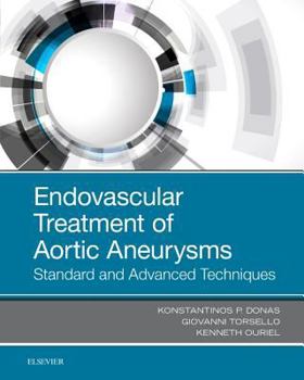 Hardcover Endovascular Treatment of Aortic Aneurysms: Standard and Advanced Techniques Book