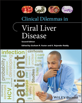 Paperback Clinical Dilemmas in Viral Liver Disease Book