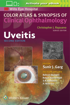 Paperback Uveitis Book