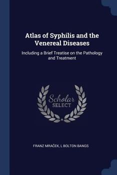 Paperback Atlas of Syphilis and the Venereal Diseases: Including a Brief Treatise on the Pathology and Treatment Book