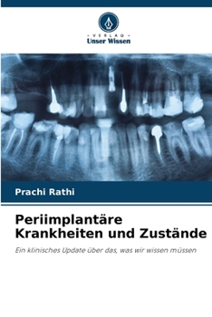 Paperback Periimplantäre Krankheiten und Zustände [German] Book