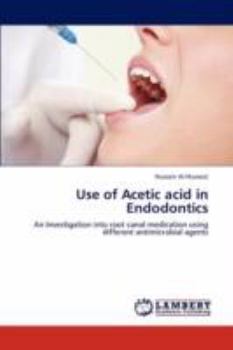 Paperback Use of Acetic acid in Endodontics Book