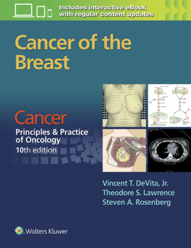 Paperback Cancer of the Breast: From Cancer: Principles & Practice of Oncology, 10th Edition Book