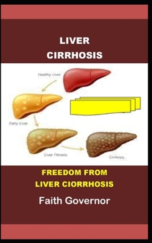 Paperback Liver Cirrhosis: Freedom from Liver Cirrhosis Book