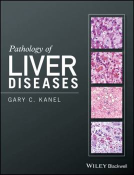 Hardcover Pathology of Liver Diseases Book
