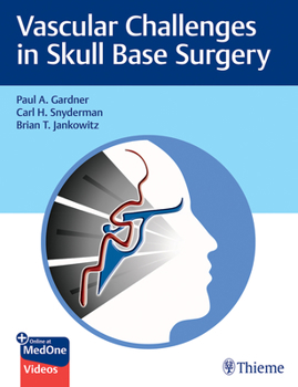 Hardcover Vascular Challenges in Skull Base Surgery Book