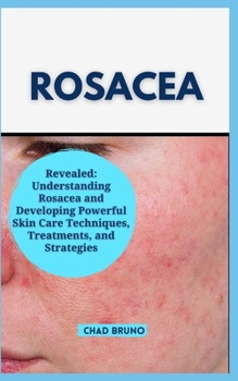 Paperback Rosacea: Revealed: Understanding Rosacea and Developing Powerful Skin Care Techniques, Treatments, and Strategies Book