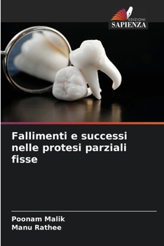 Fallimenti e successi nelle protesi parziali fisse (Italian Edition)