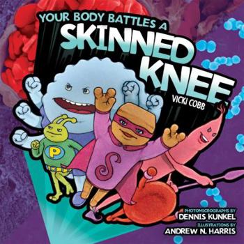 Your Body Battles a Skinned Knee (Body Battles) - Book  of the Your Amazing Body