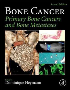 Paperback Bone Cancer: Primary Bone Cancers and Bone Metastases Book