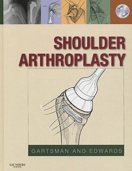 Hardcover Shoulder Arthroplasty Book