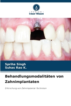 Paperback Behandlungsmodalitäten von Zahnimplantaten [German] Book