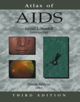 Hardcover Atlas of AIDS Book