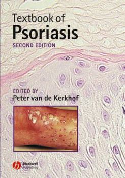 Hardcover Textbook of Psoriasis Book