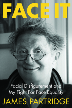 Paperback Face It: Facial Disfigurement and My Fight For Face Equality Book