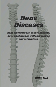 Paperback Bone Diseases: Bone disorders can cause abnormal bone weakness as well as fractures and deformities. Book
