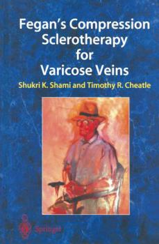 Paperback Fegan's Compression Sclerotherapy for Varicose Veins Book