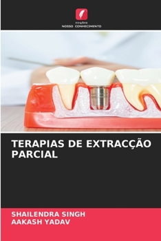 Paperback Terapias de Extracção Parcial [Portuguese] Book