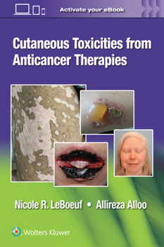 Paperback Cutaneous Toxicities from Anticancer Therapies Book