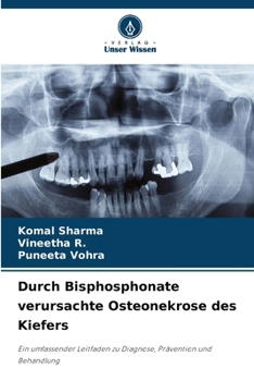 Durch Bisphosphonate verursachte Osteonekrose des Kiefers (German Edition)