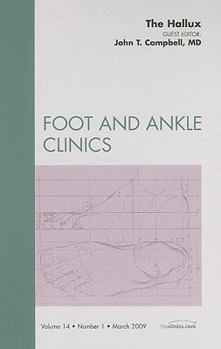 Hardcover The Hallux, an Issue of Foot and Ankle Clinics: Volume 14-1 Book