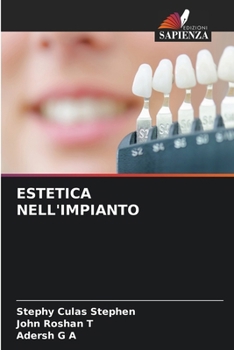 Paperback Estetica Nell'impianto [Italian] Book