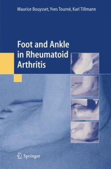Paperback Foot and Ankle in Rheumatoid Arthritis Book