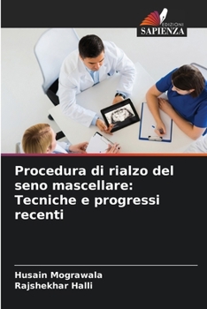 Paperback Procedura di rialzo del seno mascellare: Tecniche e progressi recenti [Italian] Book