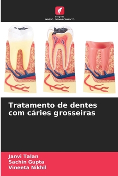 Paperback Tratamento de dentes com cáries grosseiras [Portuguese] Book