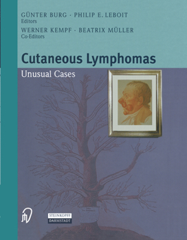 Hardcover Cutaneous Lymphomas: Unusual Cases Book