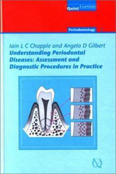 Understanding Periodontal Diseases: Assessment and Diagnostic Procedures in Practice: 1 (Quintessentials: Endontics)