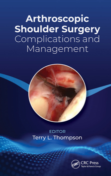 Paperback Arthroscopic Shoulder Surgery: Complications and Management Book