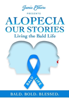 Paperback Alopecia: Our Stories: Living The Bald Life Book
