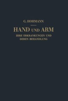 Paperback Hand Und Arm: Ihre Erkrankungen Und Deren Behandlung [German] Book