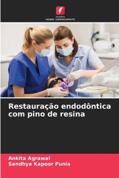 Restauração endodôntica com pino de resina (Portuguese Edition)