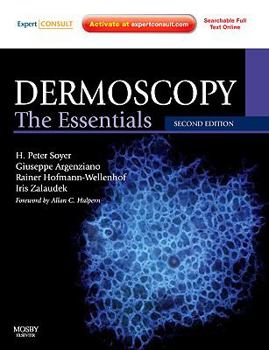 Paperback Dermoscopy: The Essentials: Expert Consult - Online and Print Book