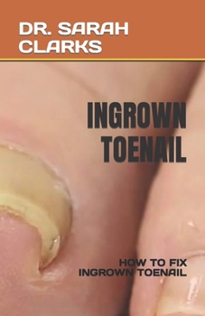 Paperback Ingrown Toenail: How to Fix Ingrown Toenail Book