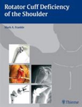 Hardcover Rotator Cuff Deficiency of the Shoulder Book