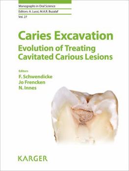 Hardcover Caries Excavation: Evolution of Treating Cavitated Caries Lesions (Monographs In Oral Science) Book