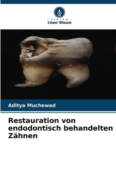 Paperback Restauration von endodontisch behandelten Zähnen [German] Book