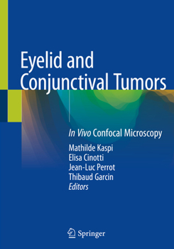 Paperback Eyelid and Conjunctival Tumors: In Vivo Confocal Microscopy Book