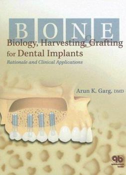 Hardcover Bone Biology, Harvesting, Grafting for Dental Implants: Rationale and Clinical Applications Book